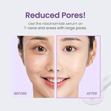 TIRTIR Niacinamide 20% Serum Before&After | Korean Beauty Products NZ