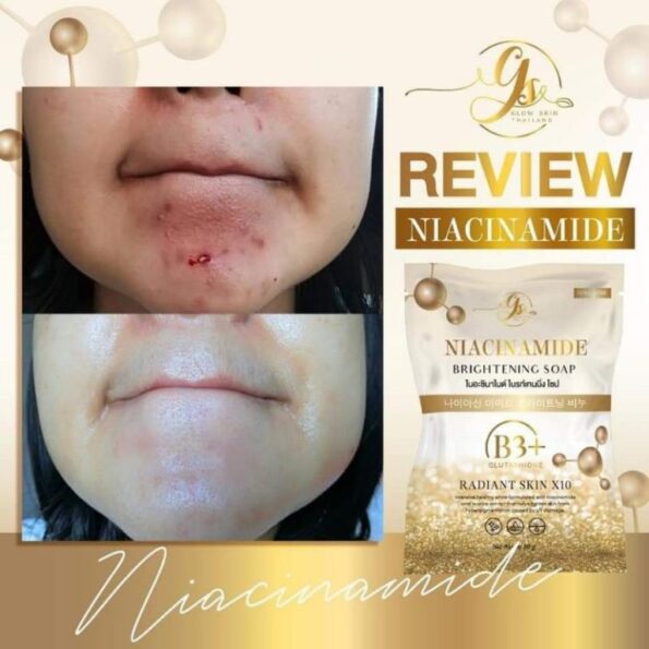 Lady shows the effect when you apply Glow Skin Niacinamide Brightening Soap with B3+ Glutathione, radiant skin X10 | Thai Beauty Products NZ