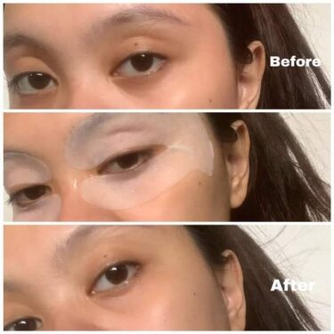 Before & after of Puff and Bloom Eye de-Puff Mask, hyaluronic eye mask with vitamin c+nicotinamide, 50pcs | Filipino Beauty Products NZ