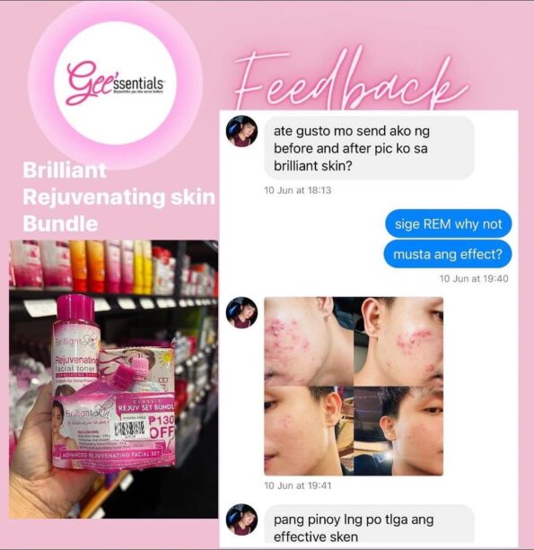 Customer's feedback, before and after photo for using Brilliant Skin Essentials Rejuvenating Set Upsize Bundle (Kojic Acid Soap, Rejuvenating Facial Toner, Rejuvenating Facial Cream & Sunblock Gel-Cream) | Filipino Beauty Products NZ