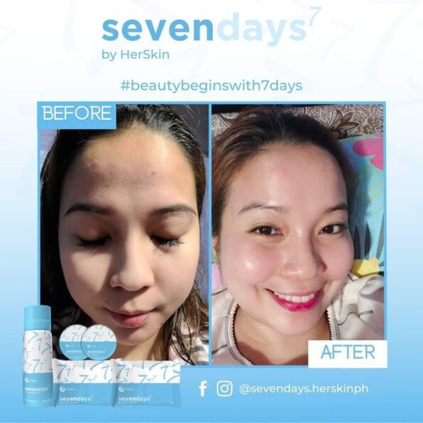 Before & after result by using Her Skin 7 Days Power Exfoliating Set | Filipino Beauty Products NZ