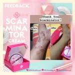 Skin Sensation Scar-Minator