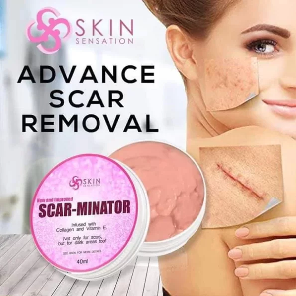 Result of Skin sensation Scar-Minator, infused with collagen & vit e. Not only for scars, but for dark areas too | Filipino Skin Care Shop Nz