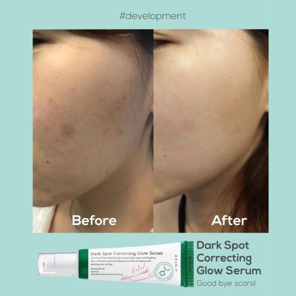 AXIS-Y Dark Spot Correcting Glow Serum Before After | Korean Beauty Products NZ