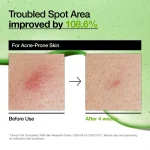 ANUA Azealic Acid Serum03
